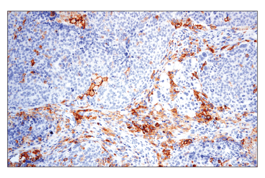 Immunohistochemistry Image 4: CD86 (E2G8P) Rabbit mAb (BSA and Azide Free)