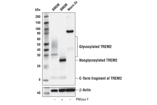 Western Blotting Image 1: TREM2 (E7P8J) Rabbit mAb (Carboxy-terminal Antigen)