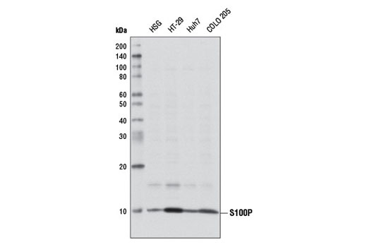 Western Blotting Image 1: S100P Antibody