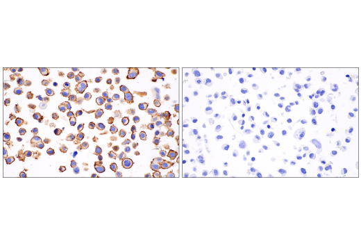 Immunohistochemistry Image 7: HER2/ErbB2 (CB11) Mouse mAb