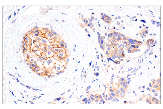 Immunohistochemistry Image 1: HER2/ErbB2 (CB11) Mouse mAb