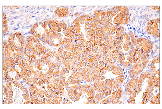 Immunohistochemistry Image 3: HER2/ErbB2 (CB11) Mouse mAb
