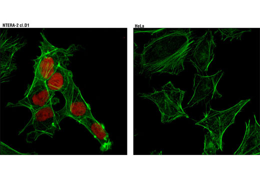 Immunofluorescence Image 1: Sox2 (D6D9) XP® Rabbit mAb (Alexa Fluor® 594 Conjugate)