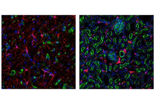 Immunofluorescence Image 1: HS1 (D5A9) XP® Rabbit mAb (Alexa Fluor® 647 Conjugate)