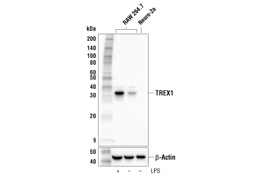Western Blotting Image 1: TREX1 Antibody