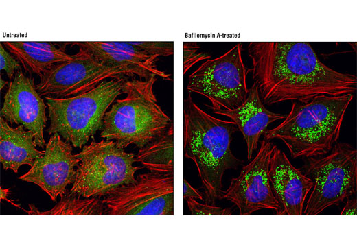 Immunofluorescence Image 1: SQSTM1/p62 (D10E10) Rabbit mAb (IF Preferred)