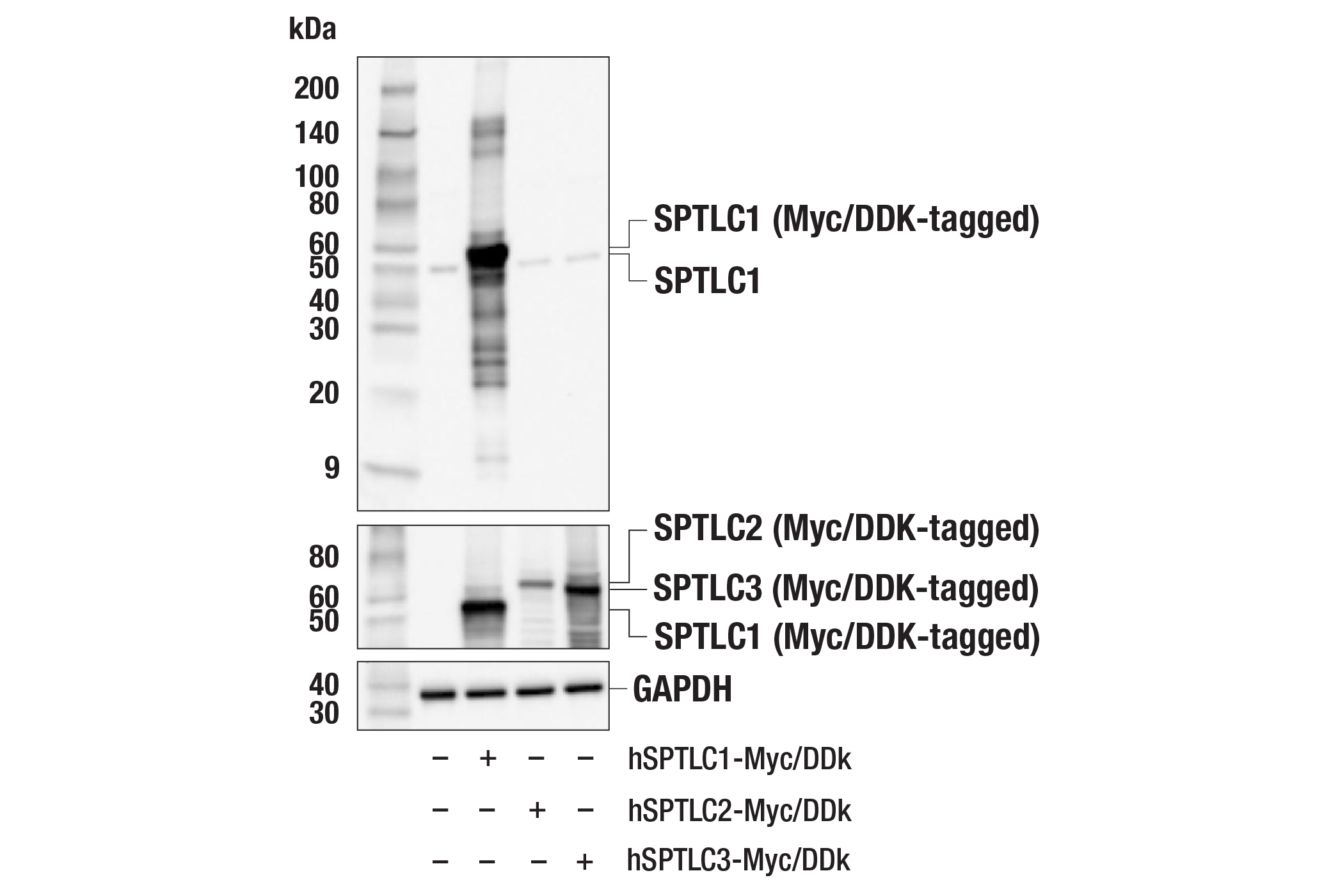 Western Blotting Image 2: SPTLC1 (F7Y7S) Rabbit mAb