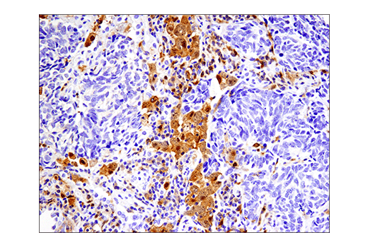 Immunohistochemistry Image 5: IRF-5 (E7F9W) Rabbit mAb