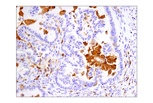 Immunohistochemistry Image 6: IRF-5 (E7F9W) Rabbit mAb