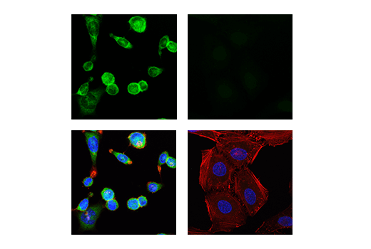Immunofluorescence Image 1: IRF-5 (E7F9W) Rabbit mAb