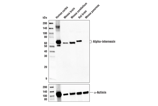 Western Blotting Image 1: Alpha-internexin Antibody