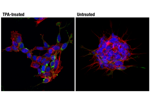 Immunofluorescence Image 2: Neuropeptide Y (D7Y5A) XP® Rabbit mAb (BSA and Azide Free)