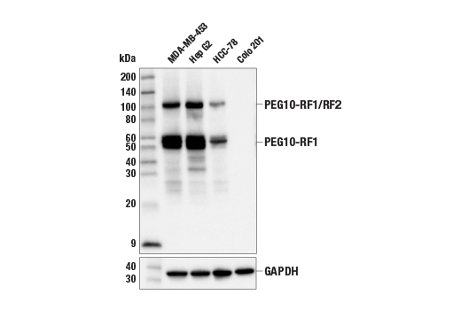 Western Blotting Image 1: PEG10 Antibody