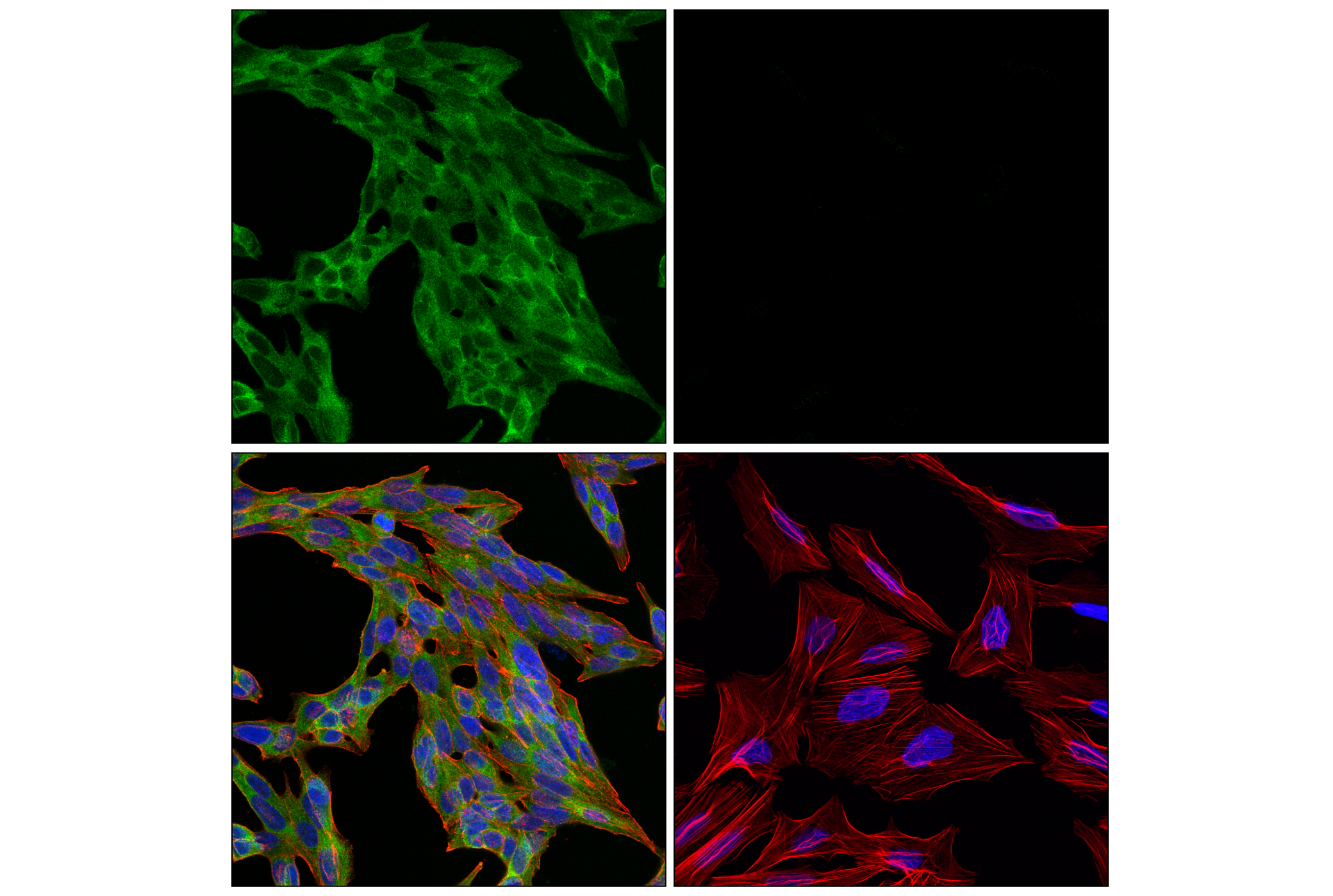 Immunofluorescence Image 2: SHP-1 (E1U6R) Rabbit mAb (Alexa Fluor® 488 Conjugate)