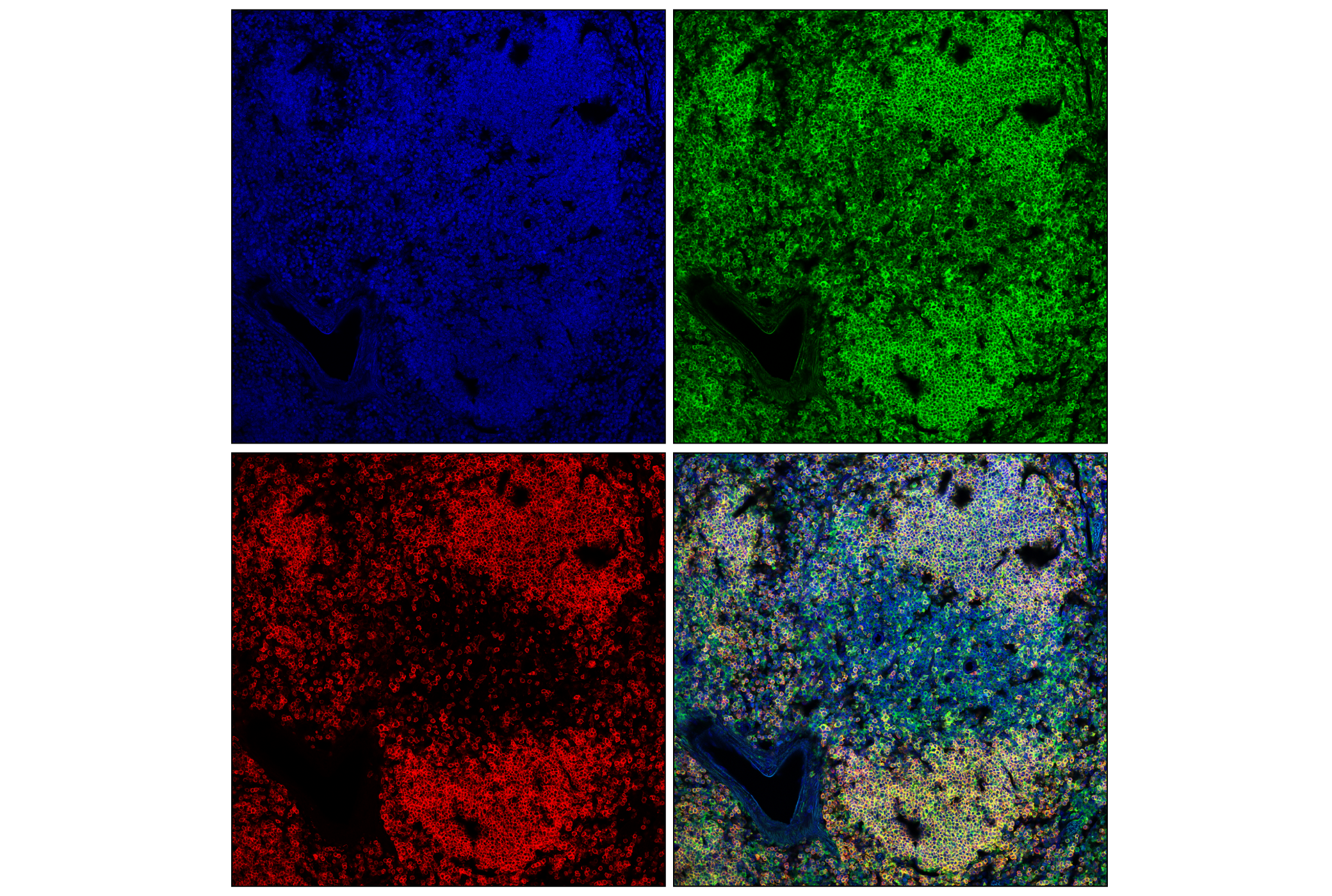 Immunofluorescence Image 1: SHP-1 (E1U6R) Rabbit mAb (Alexa Fluor® 488 Conjugate)