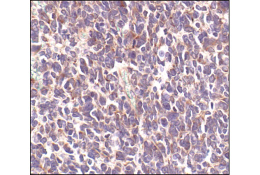 Immunohistochemistry Image 2: Neurofilament-L (DA2) Mouse mAb (BSA and Azide Free)