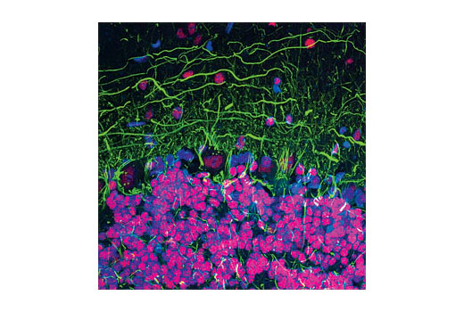 Immunofluorescence Image 1: Neurofilament-L (DA2) Mouse mAb (BSA and Azide Free)