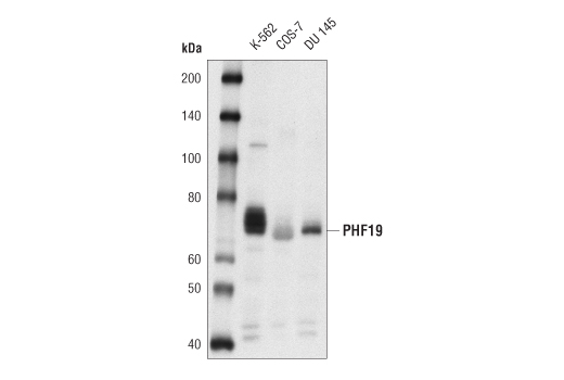 Western Blotting Image 1: PHF19 Antibody