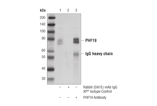 Immunoprecipitation Image 1: PHF19 Antibody