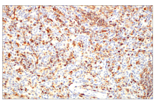 Immunohistochemistry Image 4: CD74 (D5N3I) XP® Rabbit mAb (BSA and Azide Free)