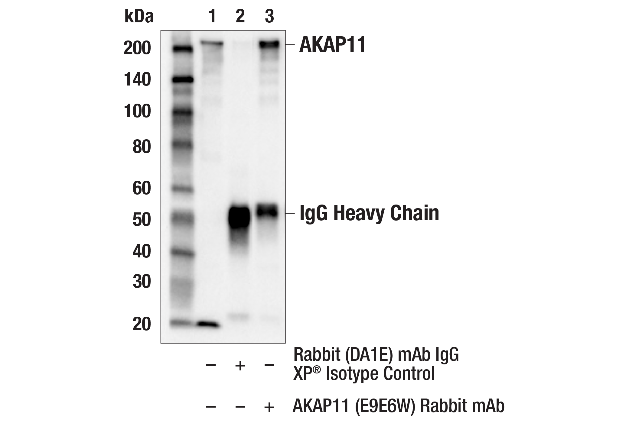 Immunoprecipitation Image 1: AKAP11 (E9E6W) Rabbit mAb