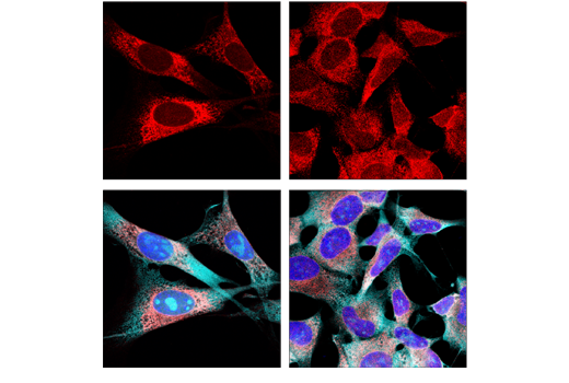 Immunofluorescence Image 1: Calreticulin (D3E6) XP® Rabbit mAb (Alexa Fluor® 594 Conjugate)