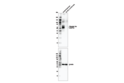  Image 20: Phospho-Tau (Ser214/T217) Signaling Antibody Sampler Kit