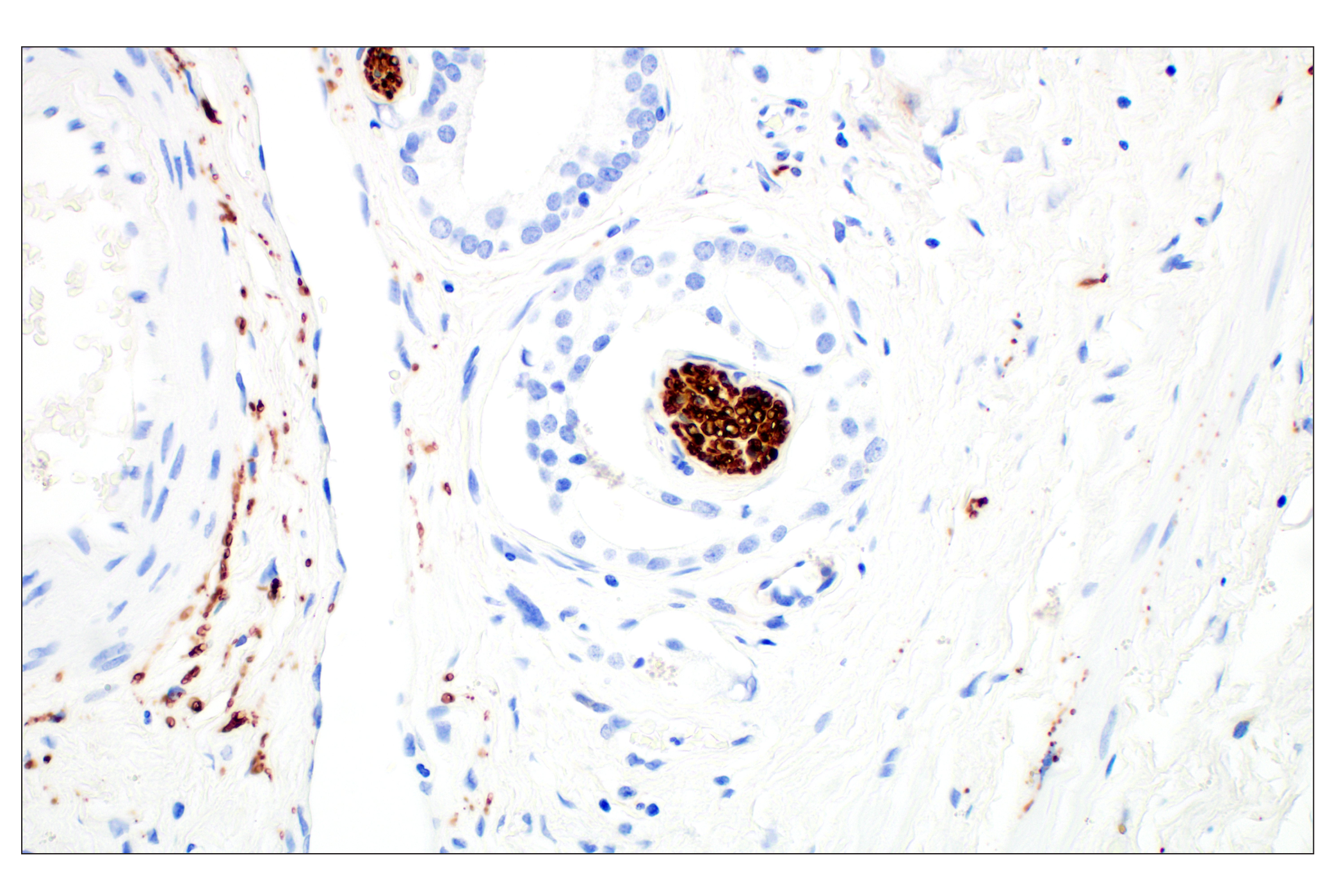 Immunohistochemistry Image 2: β3-Tubulin (E9F3E) Mouse mAb (BSA and Azide Free)