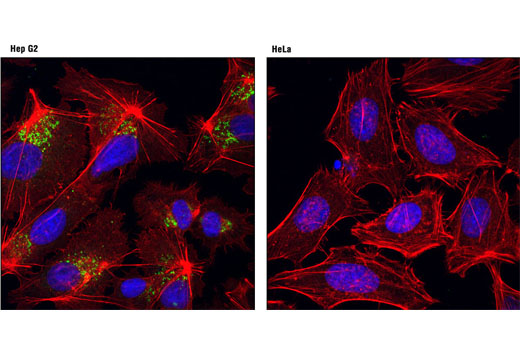 Immunofluorescence Image 1: AFP (3H8) Mouse mAb (Alexa Fluor® 488 Conjugate)