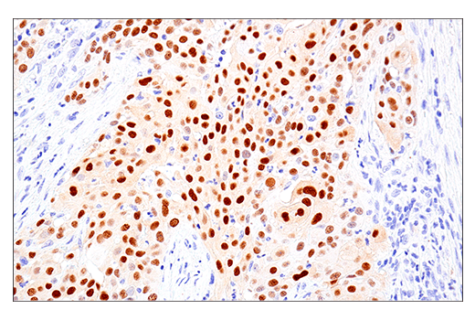 Immunohistochemistry Image 2: MAGE-A10 (E9V2Q) Rabbit mAb (BSA and Azide Free)