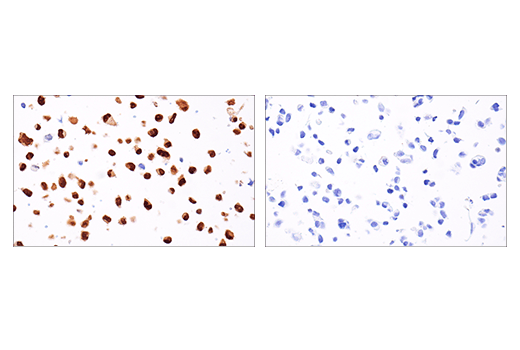 Immunohistochemistry Image 3: MAGE-A10 (E9V2Q) Rabbit mAb (BSA and Azide Free)