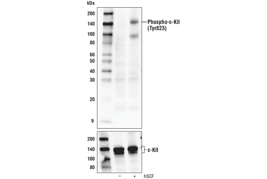 Western Blotting Image 1: Phospho-c-Kit (Tyr823) Antibody