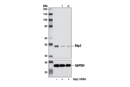  Image 1: SignalSilence® Skp2 siRNA II