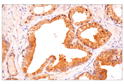 Immunohistochemistry Image 2: B-Raf (E3T5C) Mouse mAb