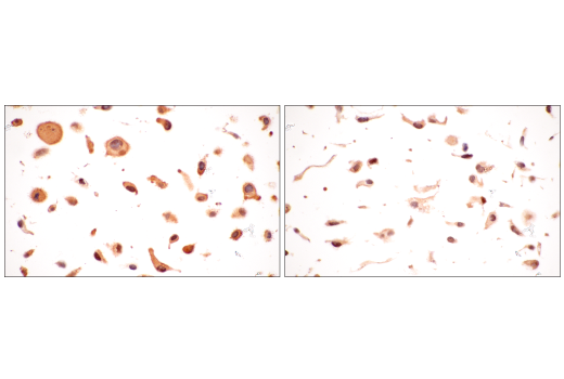 Immunohistochemistry Image 12: B-Raf (E3T5C) Mouse mAb