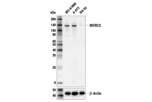Western Blotting Image 1: MORC2 Antibody