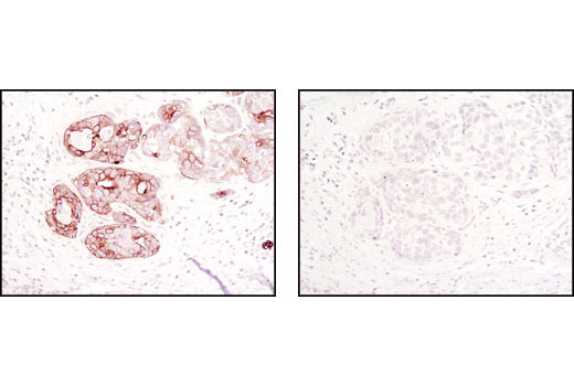 Immunohistochemistry Image 1: Jak1 (6G4) Rabbit mAb (BSA and Azide Free)