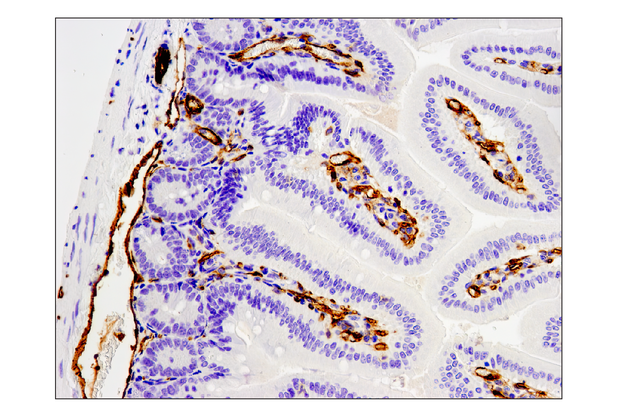 Immunohistochemistry Image 1: CD31 (PECAM-1) (D8V9E) XP® Rabbit mAb