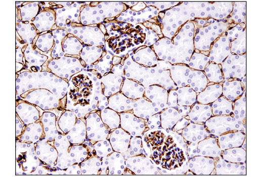 Immunohistochemistry Image 2: CD31 (PECAM-1) (D8V9E) XP® Rabbit mAb