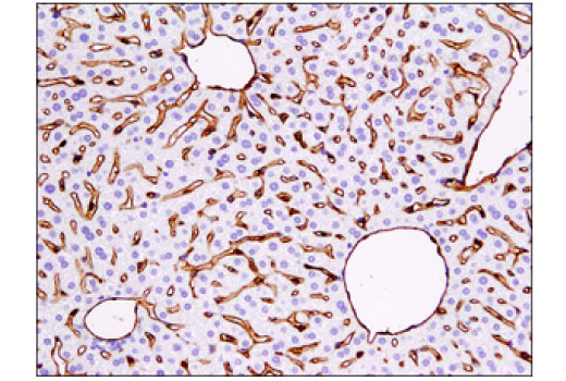 Immunohistochemistry Image 3: CD31 (PECAM-1) (D8V9E) XP® Rabbit mAb
