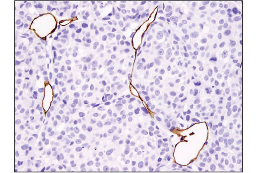Immunohistochemistry Image 4: CD31 (PECAM-1) (D8V9E) XP® Rabbit mAb