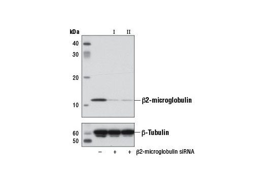  Image 1: SignalSilence® β2-microglobulin siRNA II
