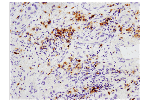 Immunohistochemistry Image 1: GITR (D9I9D) Rabbit mAb (BSA and Azide Free)
