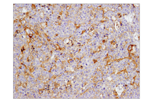 Immunohistochemistry Image 4: CD40 (D8W3N) Rabbit mAb (BSA and Azide Free)