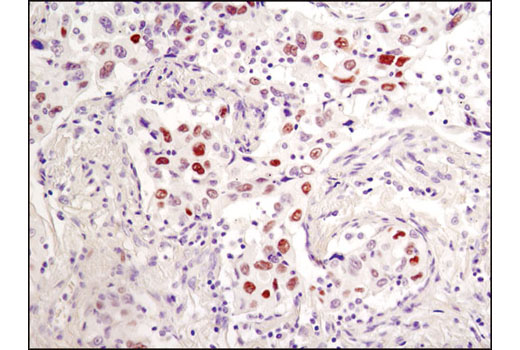 Immunohistochemistry Image 2: Phospho-c-Jun (Ser73) (D47G9) XP® Rabbit mAb (BSA and Azide Free)