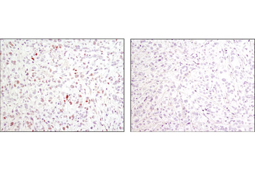 Immunohistochemistry Image 3: Phospho-c-Jun (Ser73) (D47G9) XP® Rabbit mAb (BSA and Azide Free)