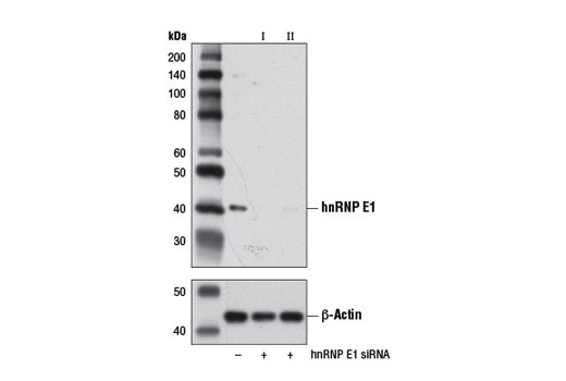  Image 1: SignalSilence® hnRNP E1 siRNA I