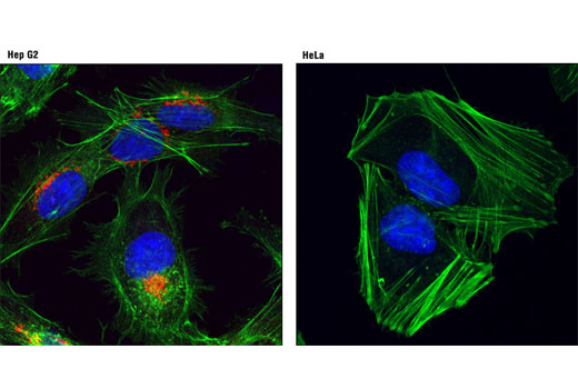 Immunofluorescence Image 1: AFP (3H8) Mouse mAb (Alexa Fluor® 555 Conjugate)