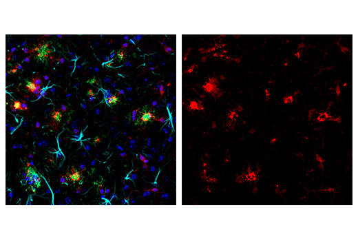 Immunofluorescence Image 1: Iba1/AIF-1 (E4O4W) XP®Rabbit mAb (Alexa Fluor® 647 Conjugate)
