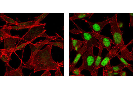Immunofluorescence Image 1: CHOP (L63F7) Mouse mAb (BSA and Azide Free)